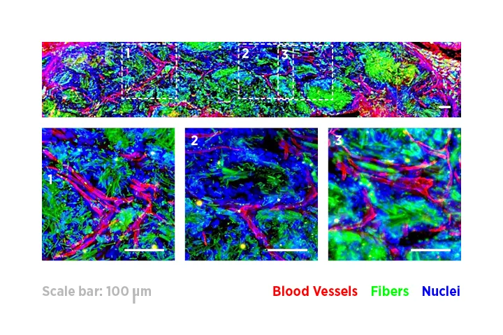 The LifeSprout Regenerative Matrix platform encourages robust vascular and cellular ingrowth. Day 84 in animal model following subcutaneous injection.