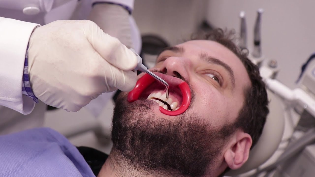 We Got $2,500 Teeth Whitening (2.1 million views)