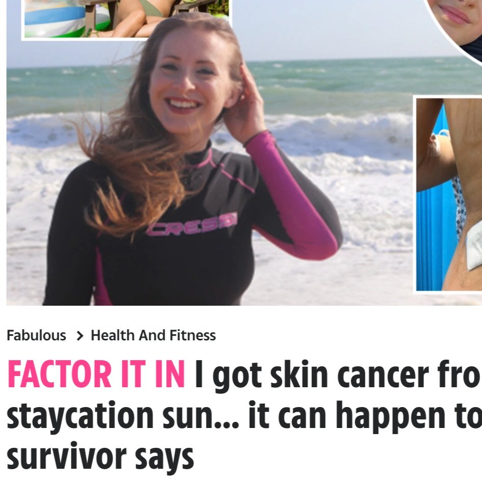 The Sun Article: FACTOR IT IN I got skin cancer from staycation sun… it can happen to anyone, survivor says