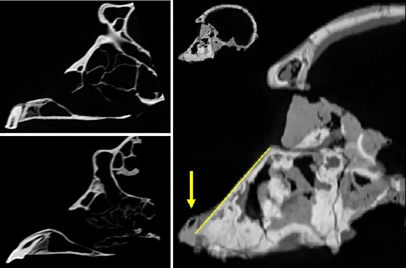 Dental eruption and age at death of fossils