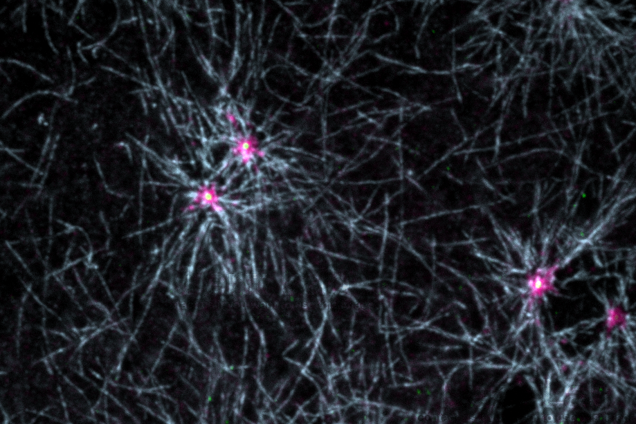 centrosome MTOCs.png