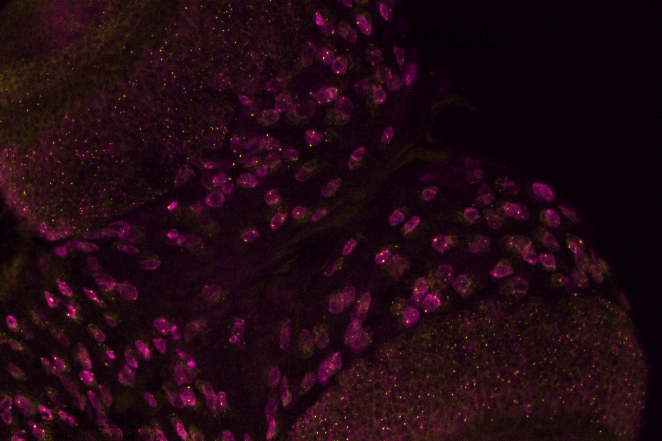 Neural Stem Cells.png