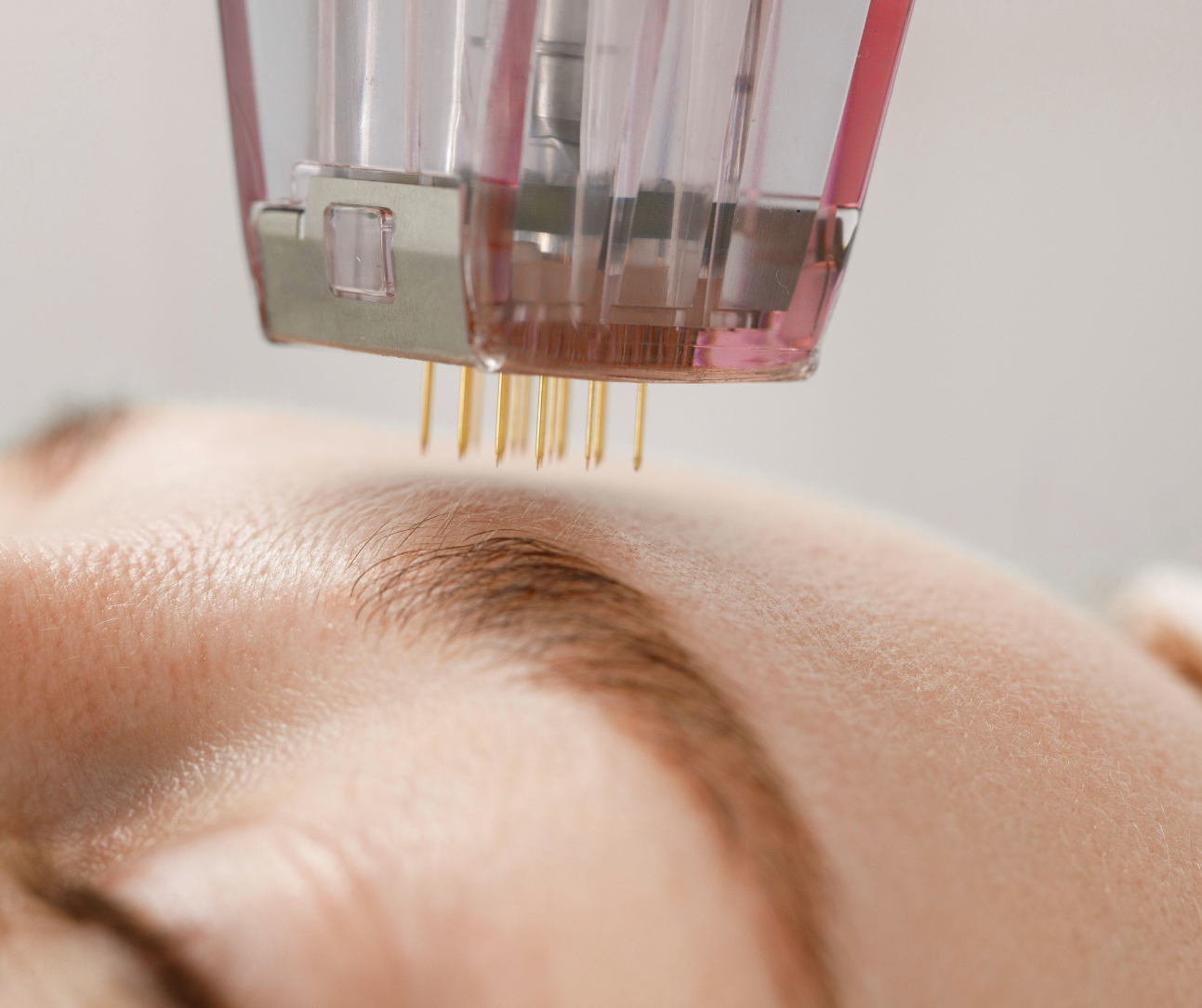 CAN YOUR SKIN BECOME MORE CONFIDENT?