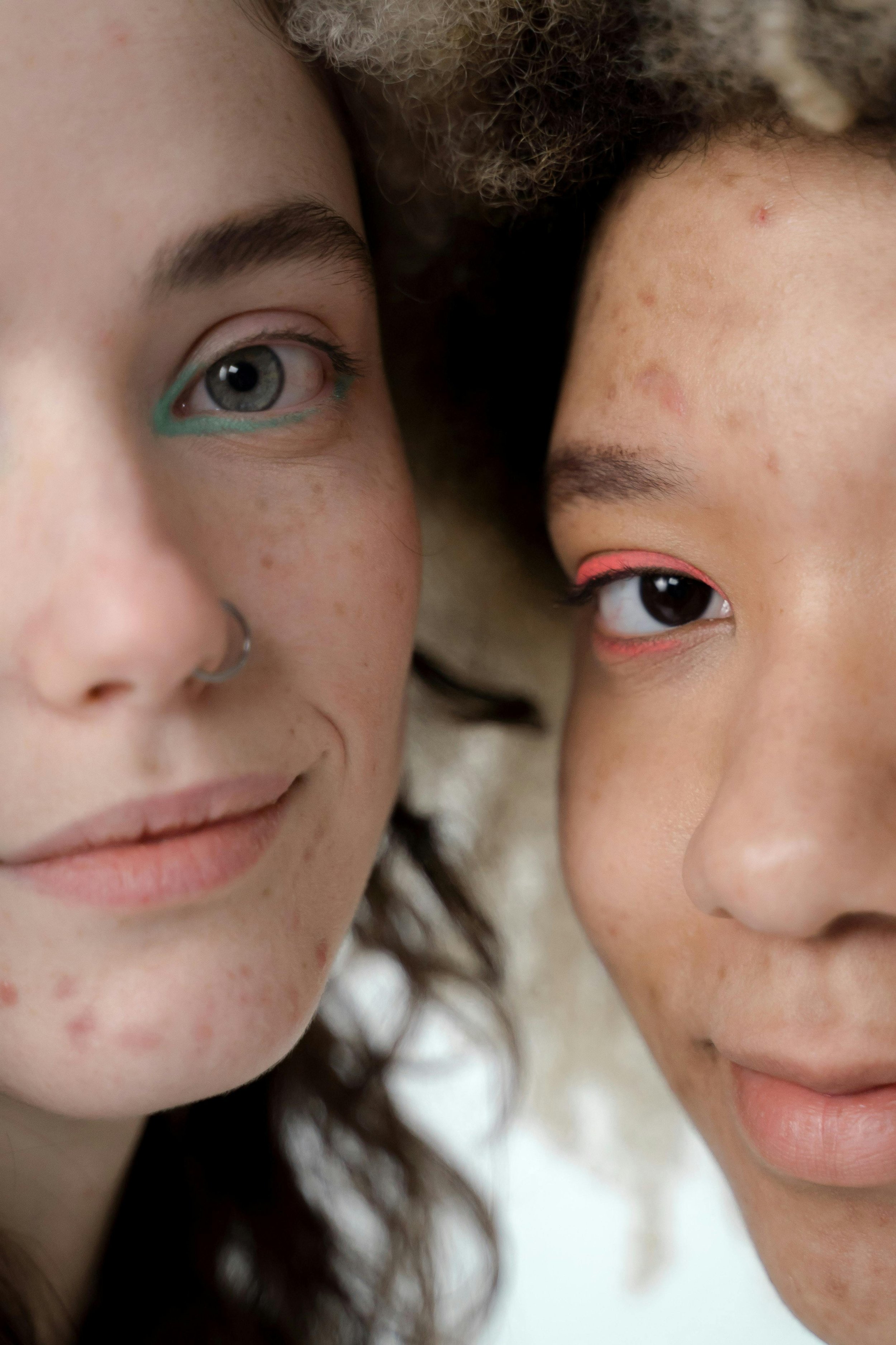 Why Acne Can Occur at Any Age: A Naturopathic Approach