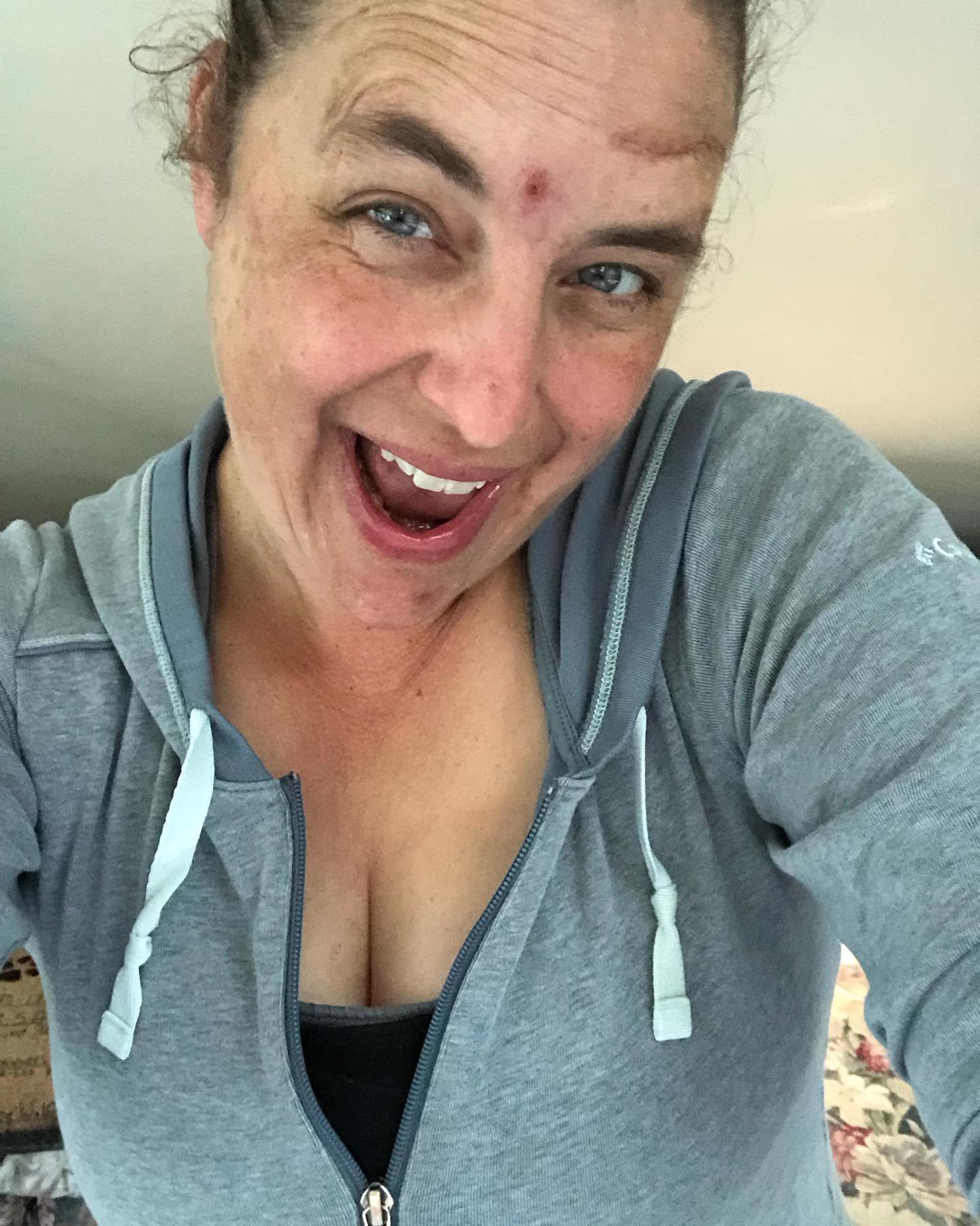 Here&rsquo;s me, my zit-o-riffic self, taking myself not so seriously. 😁 

I took a few starter photos since I was finally a pusher enough to get myself out the door for a run/walk this morn, followed by a podcast sesh and more. But the last thing w