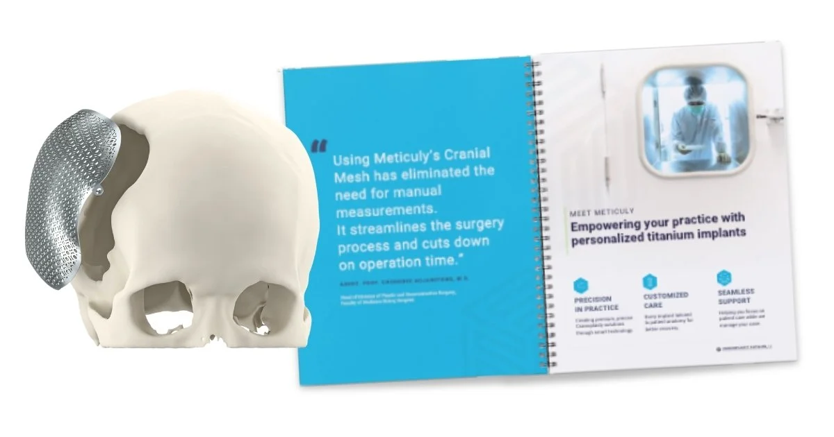  Portfolio mockup showing a 3D anatomical skull model with a titanium cranial mesh implant resting against it, displayed alongside an open spiral-bound catalog. The catalog's left page features a surgeon testimonial quote in teal, and the right page 