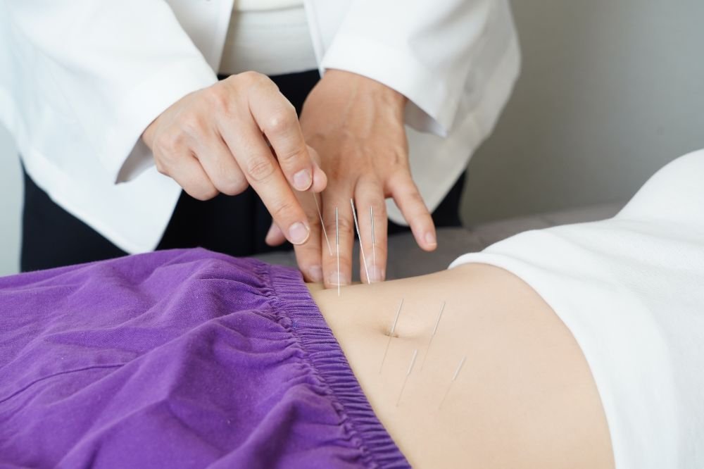 Infertility Treatment Challenges? This Acupuncture Approach Might Help
