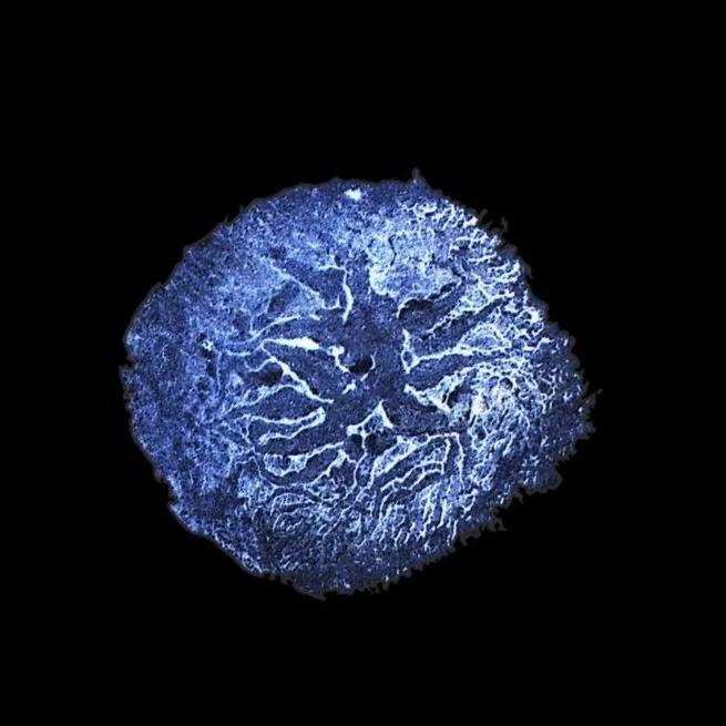 Deteriorated Stain from Century Old Glass Negative Plate - Black Background