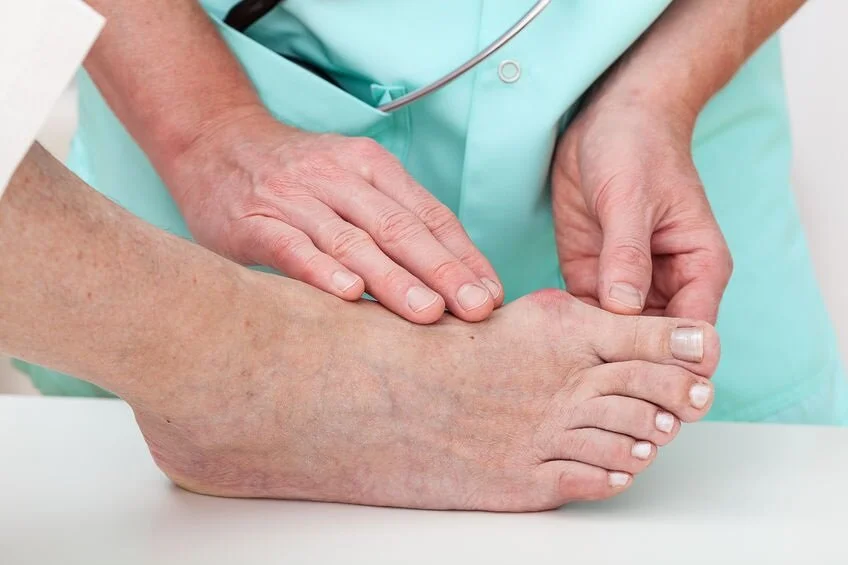 22245507_M_Diabetes_Bunion_Doctor_Patient_Feet.jpg