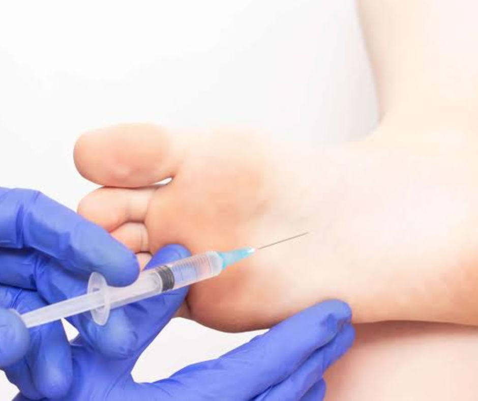 What is Foot Fat Grafting? Learn How Liposana Restores Volume and Fends Off Foot Pain