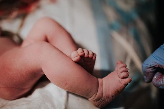 Is there anything cuter than baby toes?! I think NOT! &hearts;
.
.
.
.
.
.
.
.
#kansascitybirthphotography #kansascitybirthphotographer #kansasbirthphotographer #kansashomebirth #homebirth #bornathome #bornathomebaby #homebaby #birth #birthphotograph