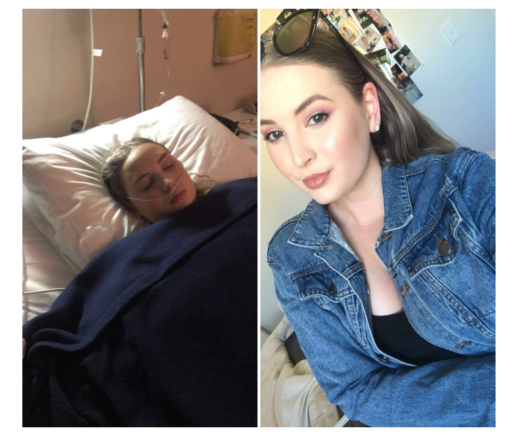 Left: After my recent surgery. Right: One year in remission.