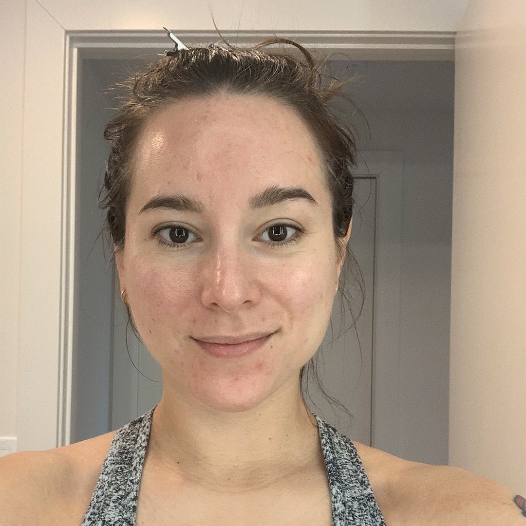 A Month Of: I've Ditched My Exfoliating Products, Week 2 Update