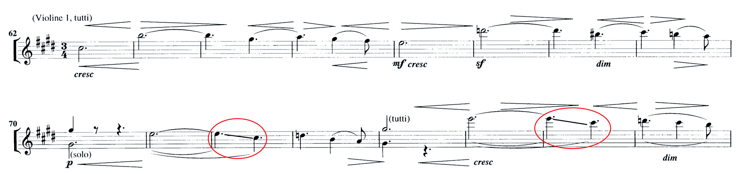 Abbildung 3: Elgar, Serenade op. 20, 1. Satz, T. 62 bis 77. Oberhalb des Systems: Norringtons realisierte Dynamik und Bogeneinteilung, unterhalb die original gedruckte und in Elgars Aufnahme realisierte Bezeichnungen.