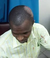 Ugandan Lecturer Beaten At Makerere University