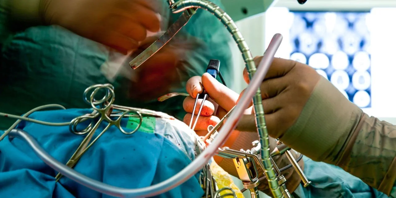 Kenya: A first as brain surgery done on awake patient at Nairobi hospital 