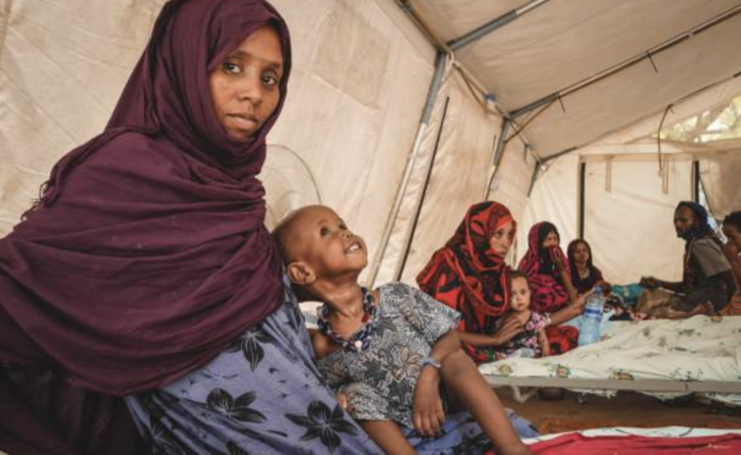 Deadly malnutrition in Ethiopia's Afar region - MSF