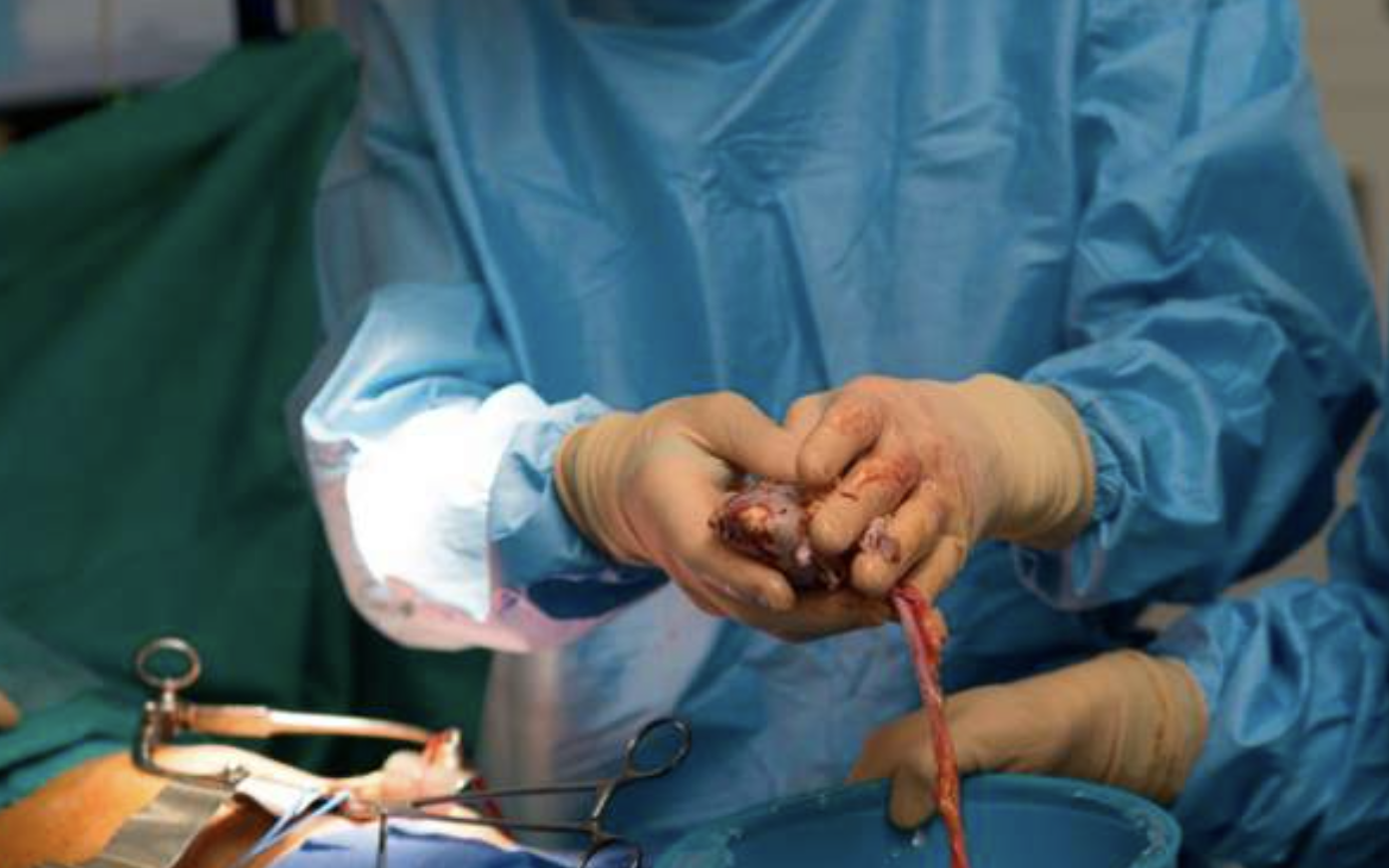 Uganda moves to outlaw trade in human organs