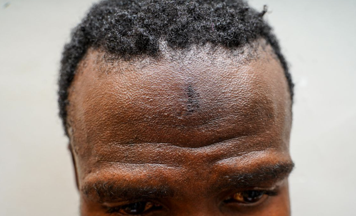 Ugandan army deny torturing opposition activist