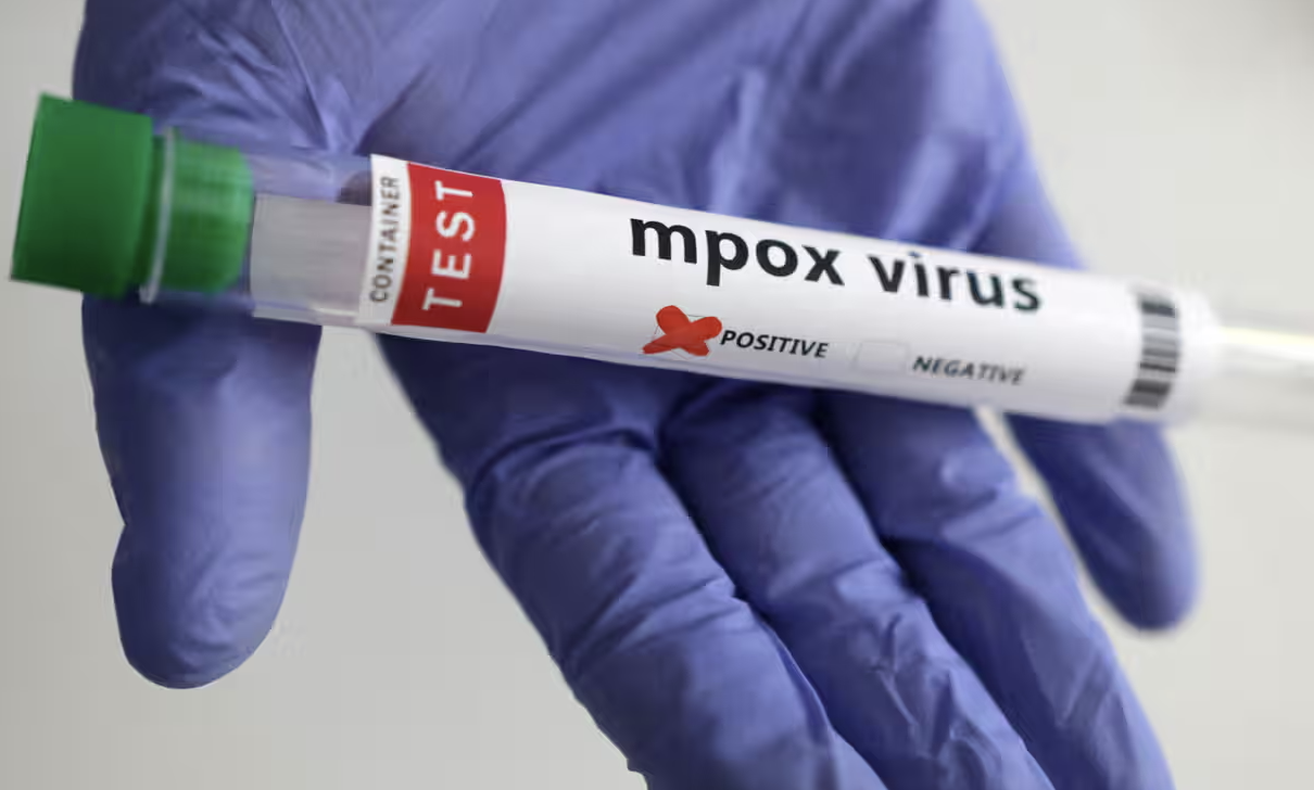 First known US case of person infected with new mpox strain reported