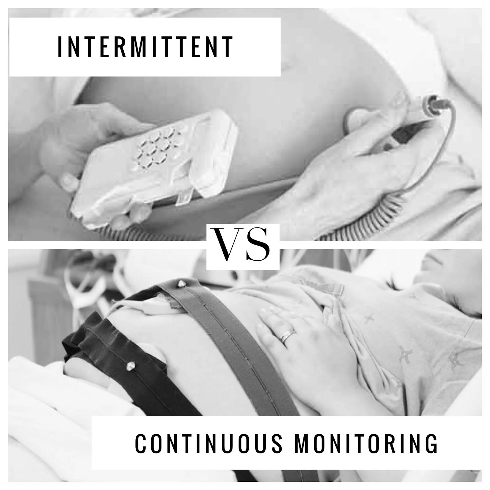 Intermittent vs Continuous Fetal Monitoring. What are they and which is better?.jpg