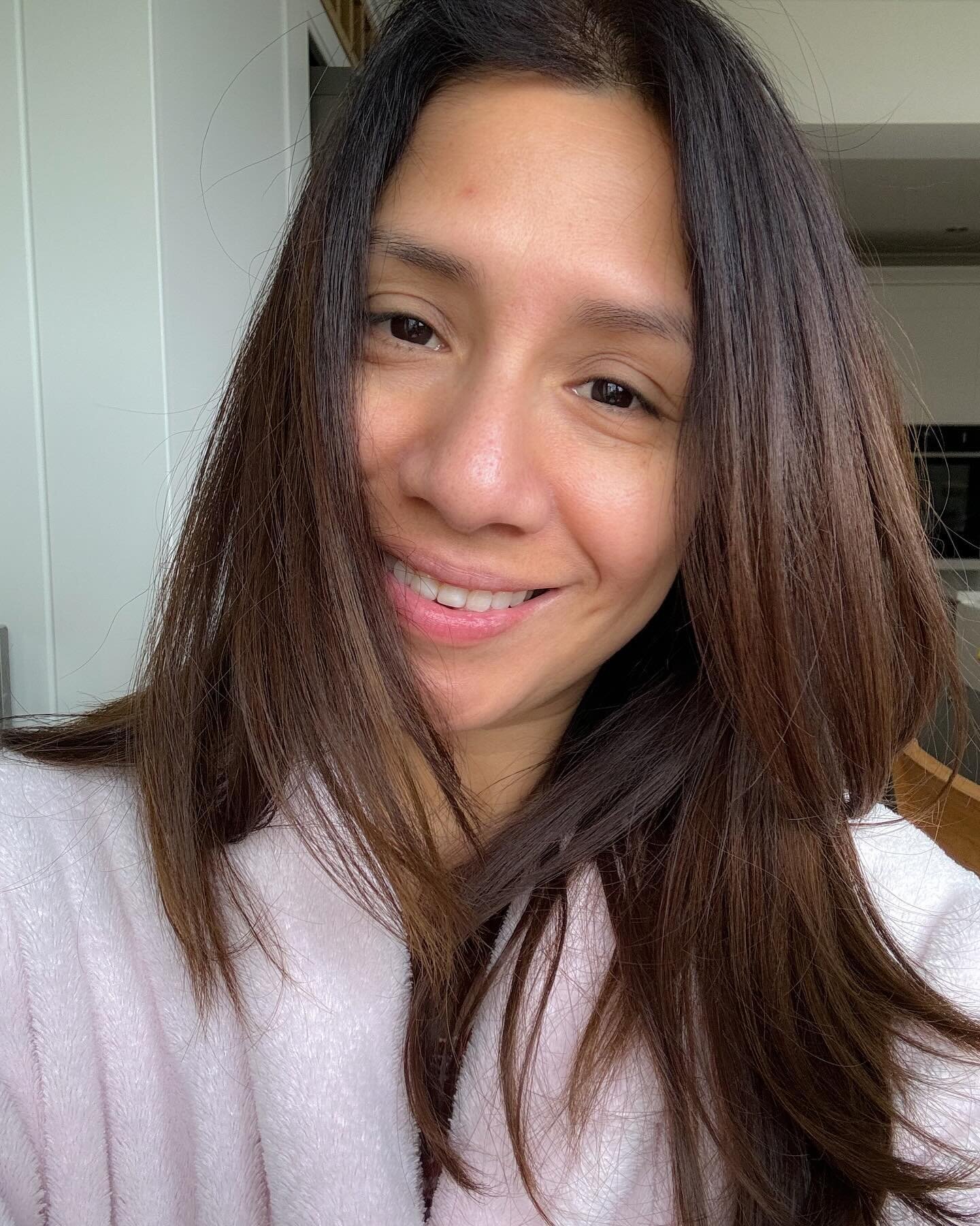 Almost two weeks after my iron infusion, I&rsquo;m finally beginning to feel better! 

This is me with a freshly-washed face and no makeup on. The colour is returning to my face, and hello to my pink lips! 😍👄

#anemia #marketingstrategy #anaemia #i