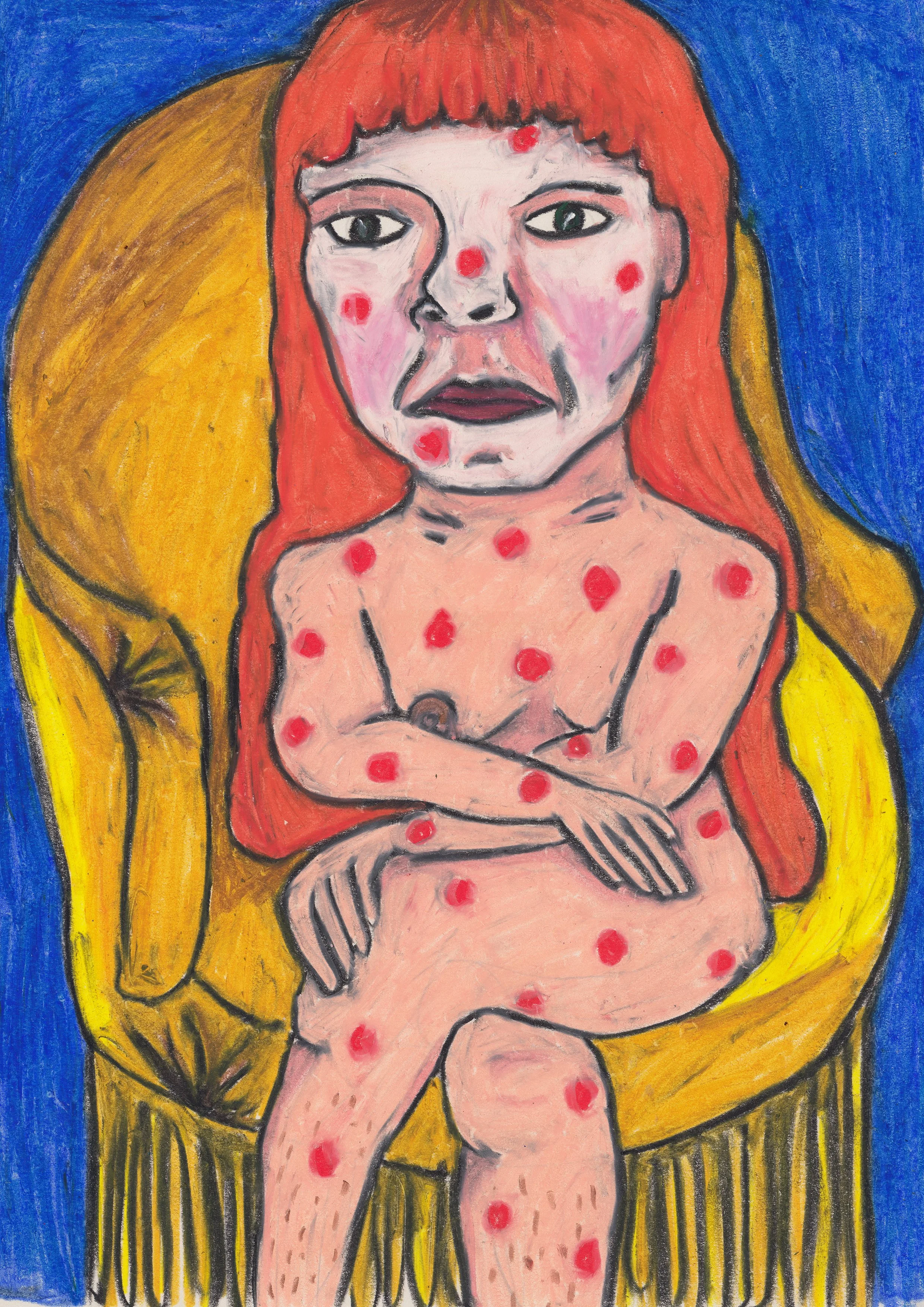 'Measles Chair' Original Drawing