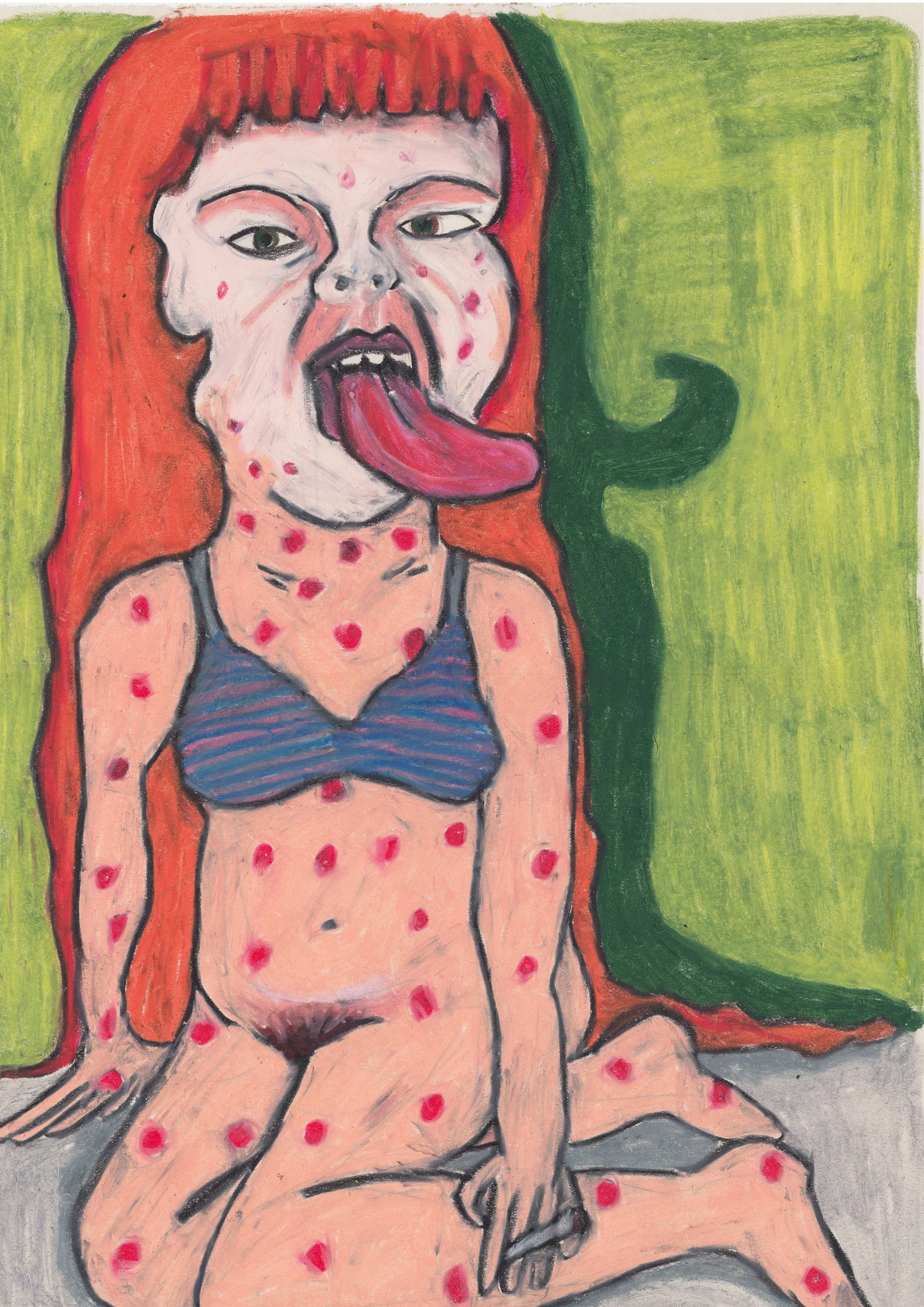 'Measles Tongue' Original Drawing