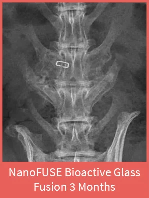 Nano_Fusion_12wks.jpg