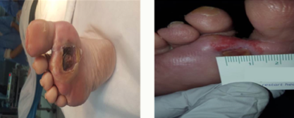 Aedicell-Case-Study-1-Photo-e1519315577110.png