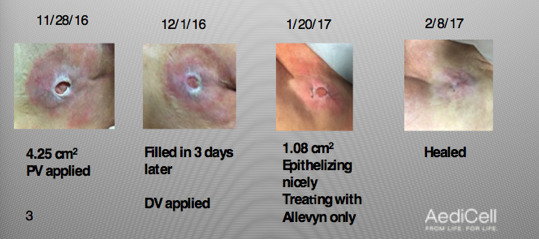 Aedicell-Case-Study-2.png