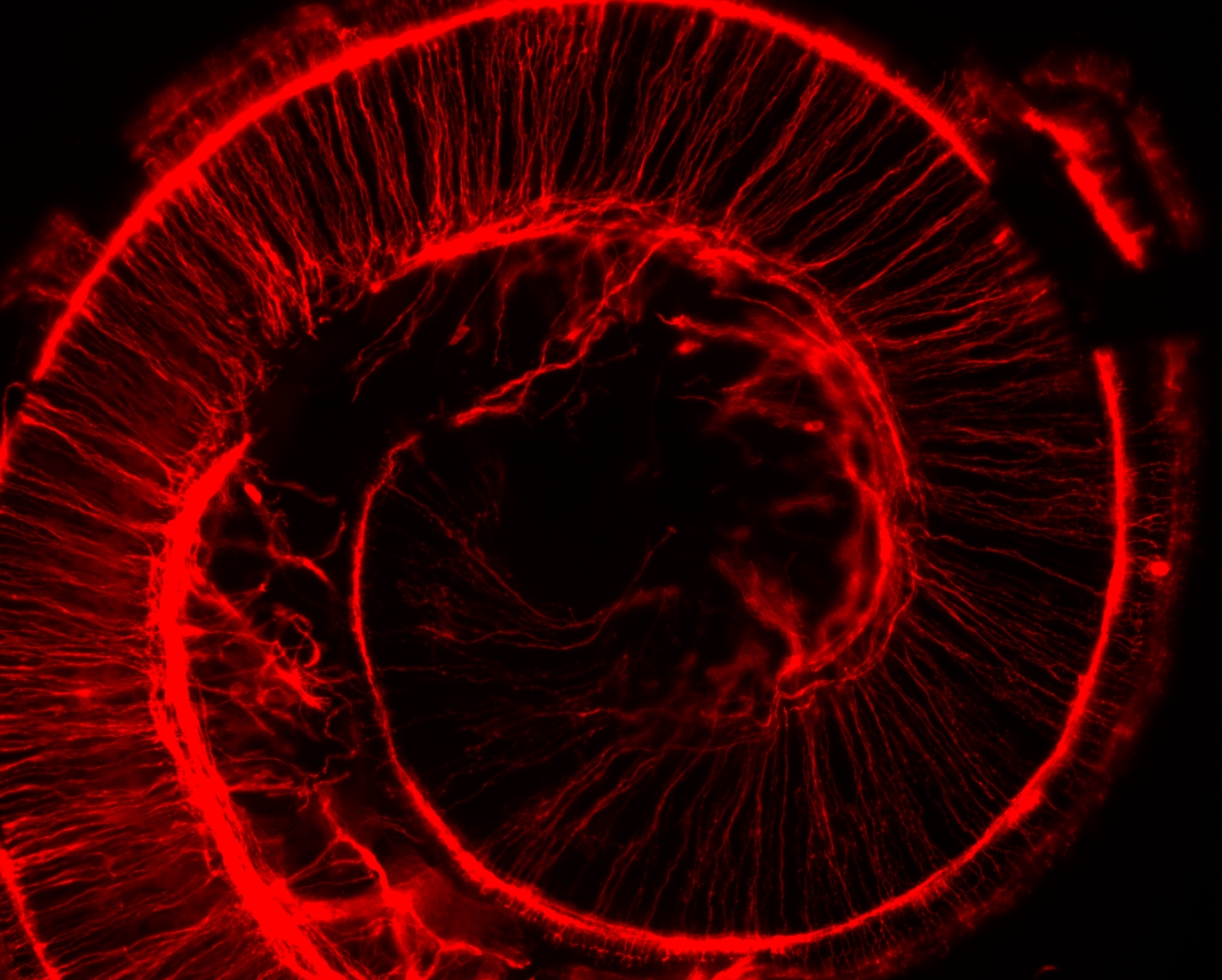 cochlea2.jpeg