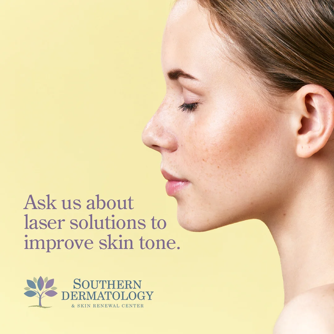 SD Hyperpigmentation_1080x1080_2-1.jpg