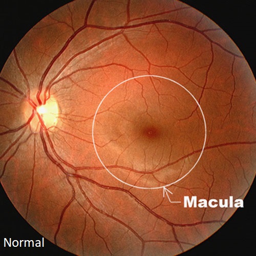 MACULA.jpg