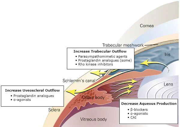 Medical therapies for open-angle glaucoma