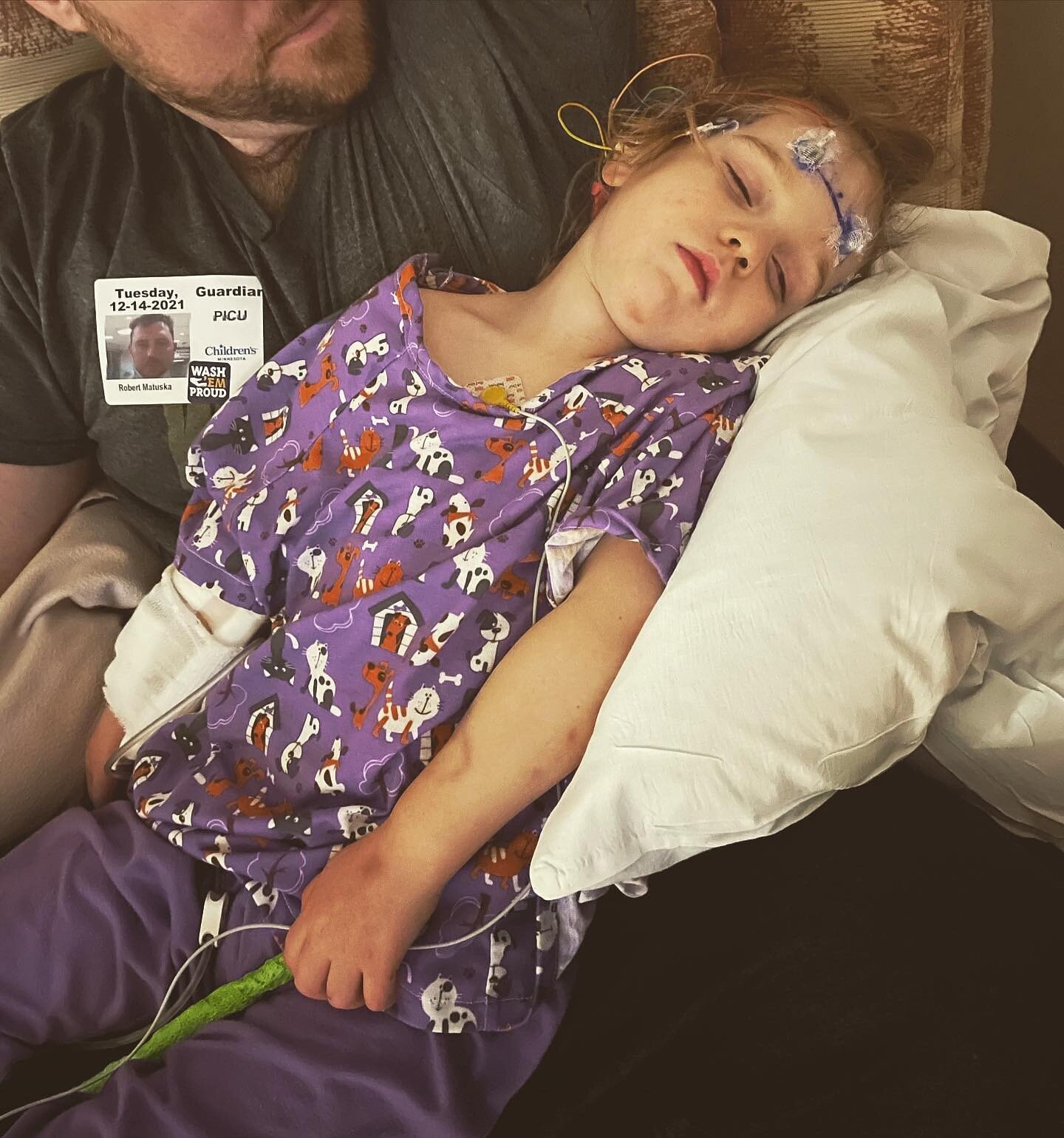 Today is International AHC Day, so an appropriate day to give an update on Lainey. ⁣
⁣
The past month has been one of the most challenging and exhausting we've had to date. Since Dec 14th, Lainey has had 12 seizures. ⁣
⁣
In the early hours of 12/14, 