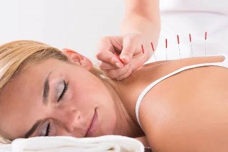 Not all Dry Needling is created equal