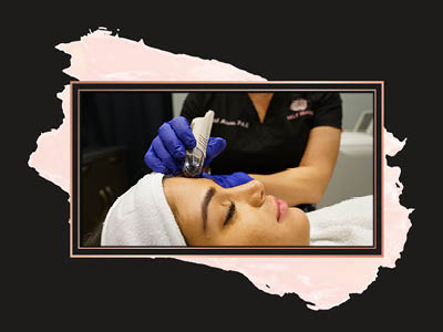 microneedle.jpg