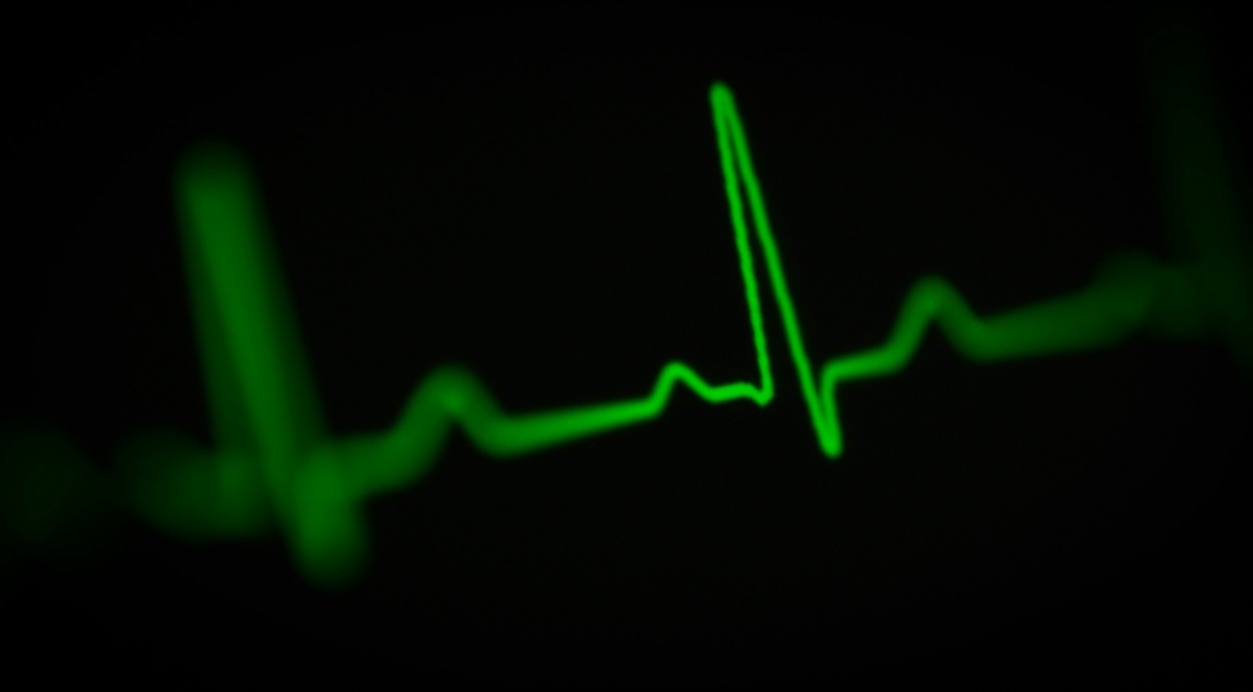 Heart Rate Variability: What It Is, How to Track It and What It Means for Your Health