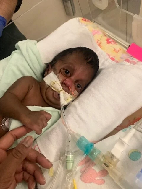 Pfeiffer Syndrome Part I- Cure?