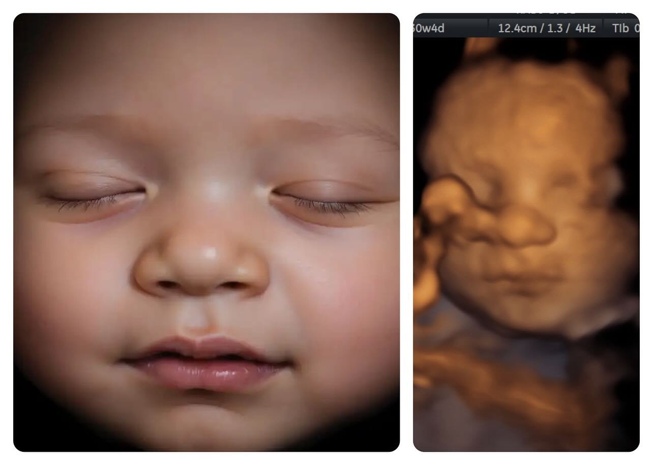 Are you wanting an ultrasound of your baby?! Is the wait between Doctor&rsquo;s visits feeling too long?! That&rsquo;s what we&rsquo;re here for! Come visit us in Baton Rouge to see your baby in 2D, 3D/4D &amp; HD ultrasound, six days a week! 

#firs