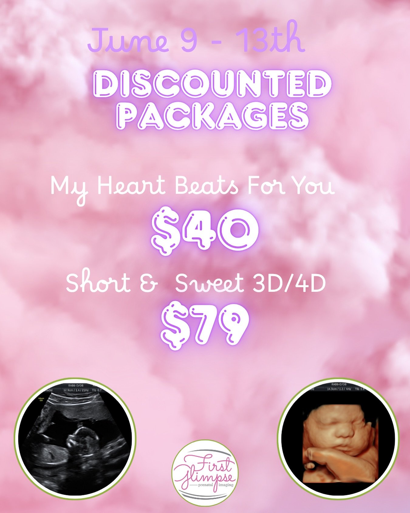 Next week marks the start of my birthday week! 🥰🩷 Share the excitement with me by snagging discounts on two popular packages! 
Discounted rates are limited to the specified days. Stay tuned for more special offers all month long! (Only valid on new