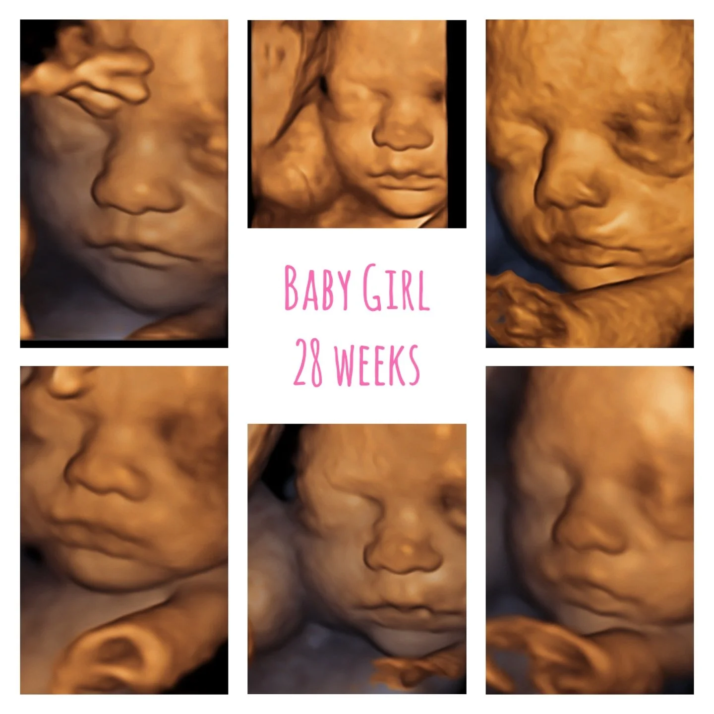 Absolutely stunning 3D images of this sweet baby! 🩷

#firstglimpsebr #pregnancy #ultrasound #sonogram #3dultrasound