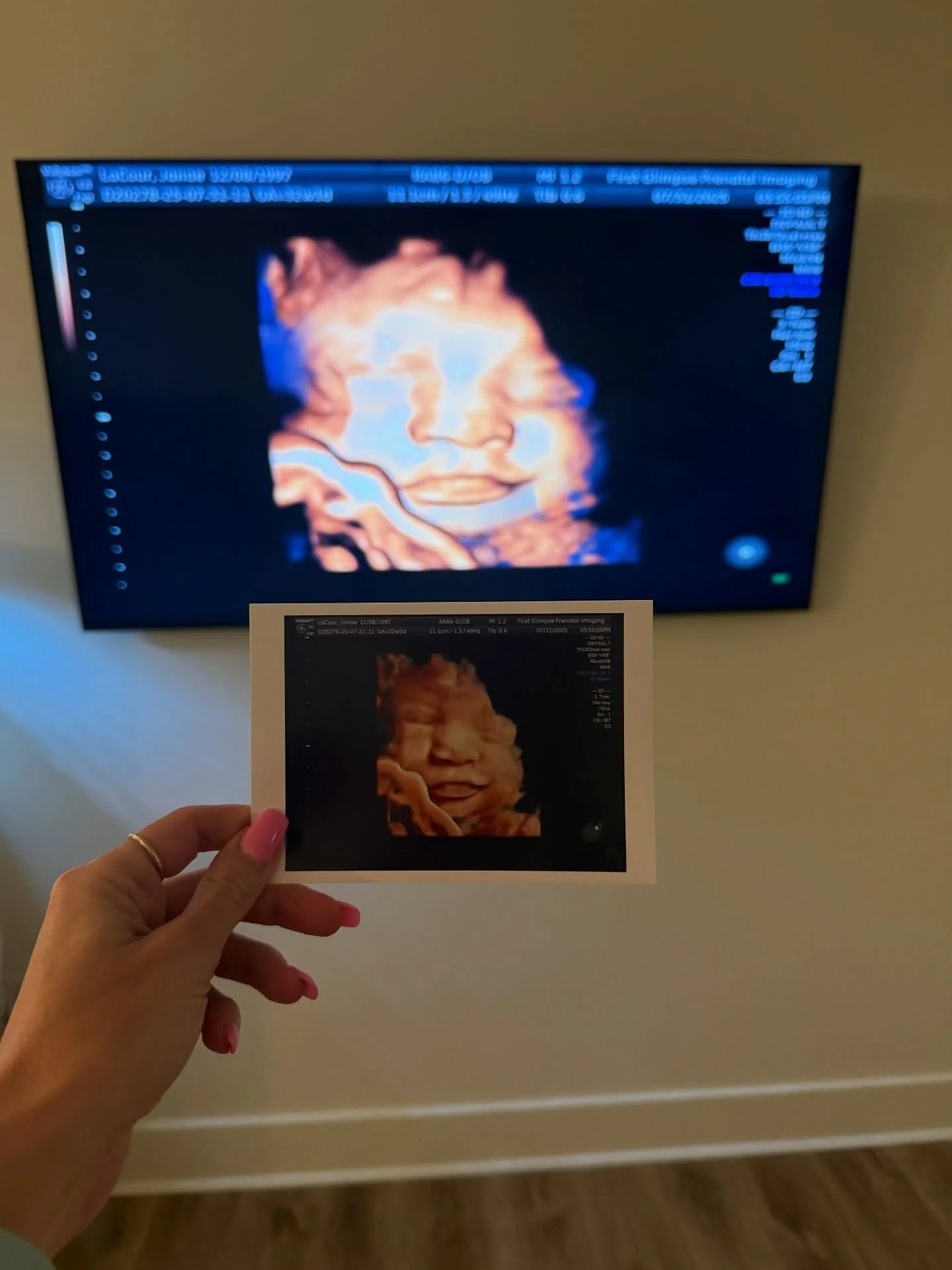 Ever just fall in love with a picture? I did with this adorable baby! All the praise for the baby cooperating &amp; allowing me these shots 😍

#firstglimpsebr #ultrasound #sonogram #pregnancy #3dultrasound #4dultrasound