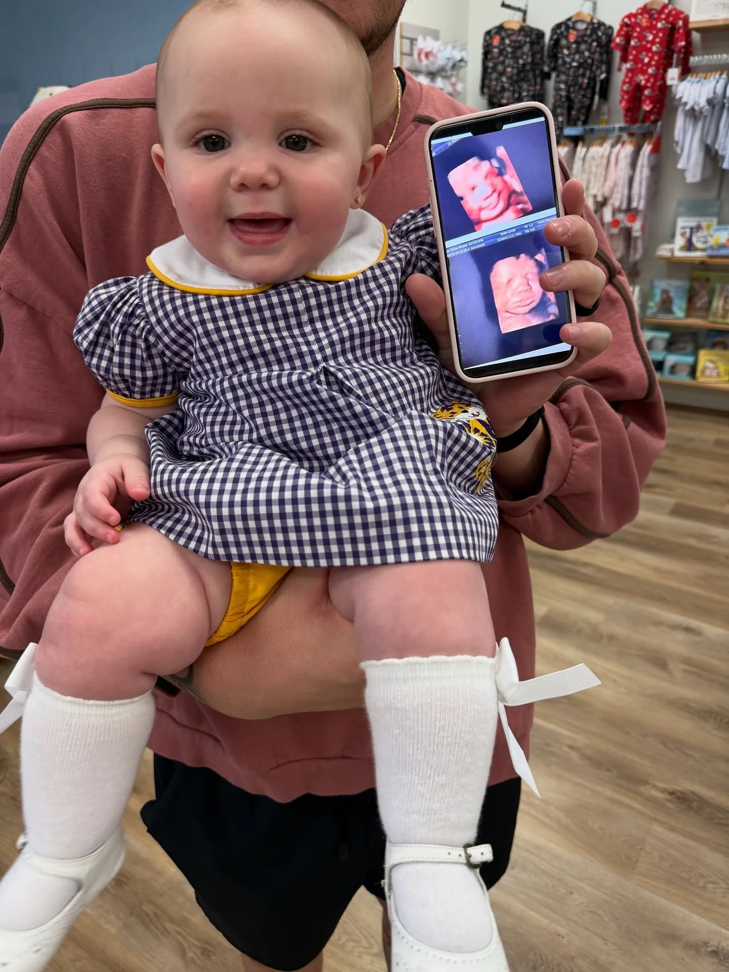 Last December we fell in love with this little one in her mom&rsquo;s belly &amp; now her family is welcoming another sweet addition! Hazel Grace is beaming with joy 😊

#firstglimpsebr #bigsister #beforeandafter #ultrasound #3dultrasound