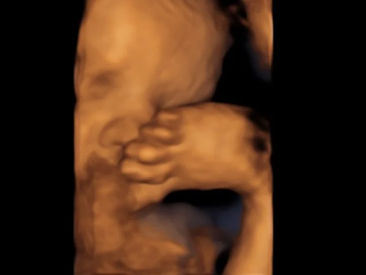 How our babies feel about Mondays&hellip;: vs how they feel about King 👑 Cake 🍰 💜💚💛 

#sonogram #pregnancy #kingcake #mardigrasbaby #firstglimpsebr