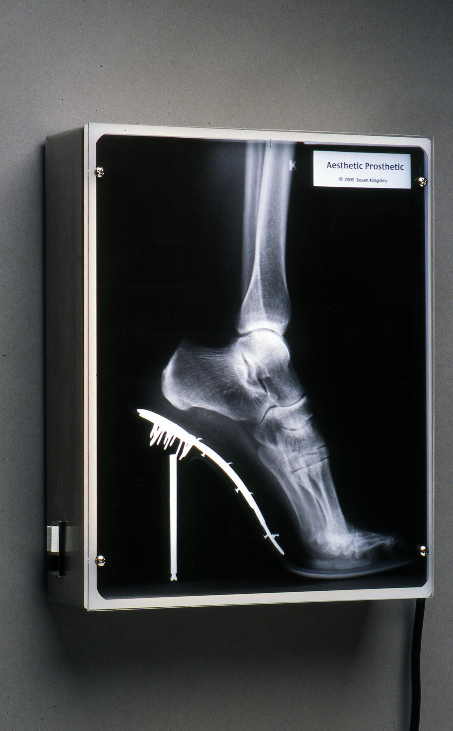 Aesthetic Prosthetic