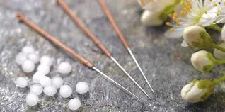 acupuncture 3.jpg