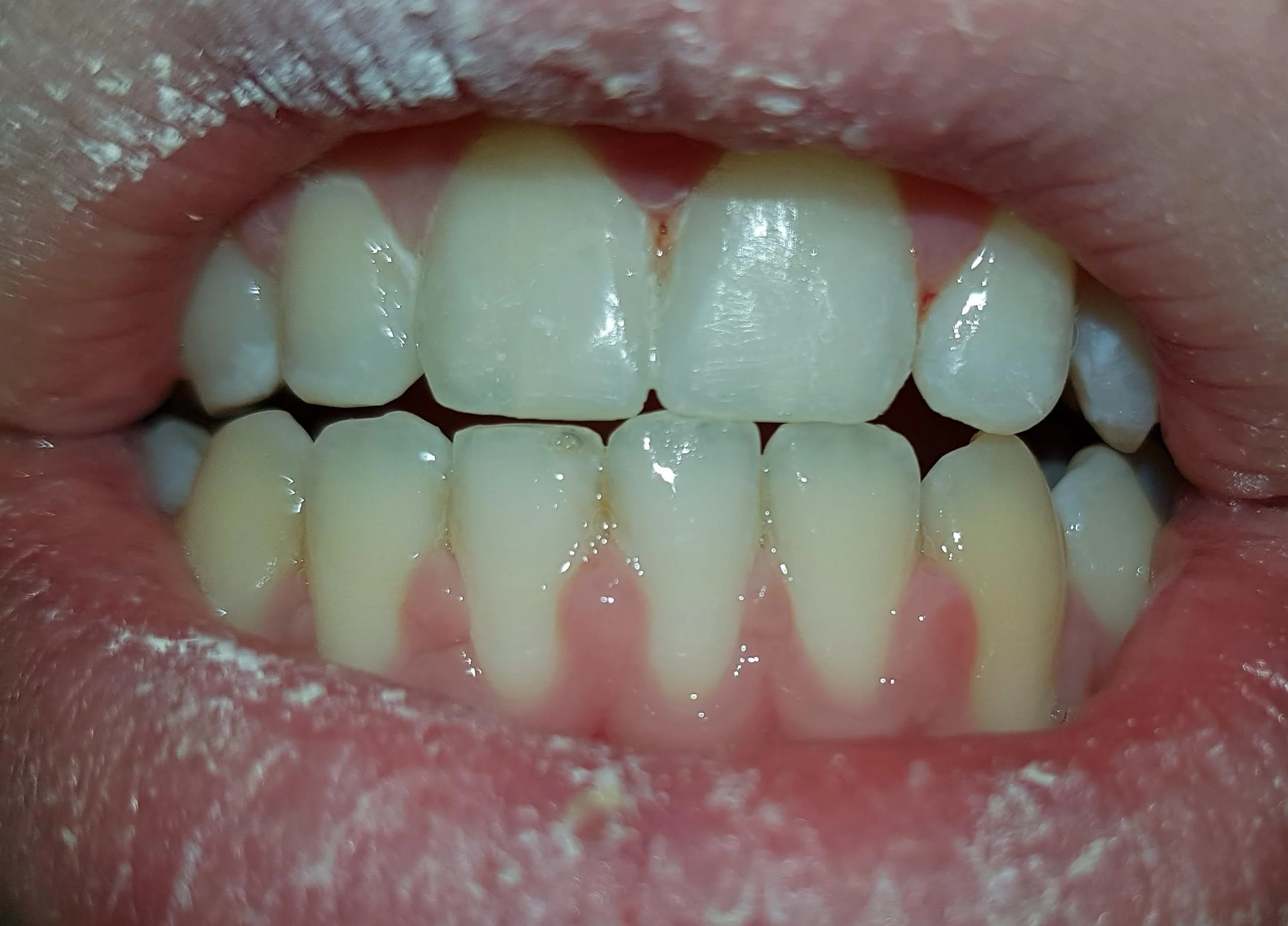 TREATMENTS — Antrim Dental Care