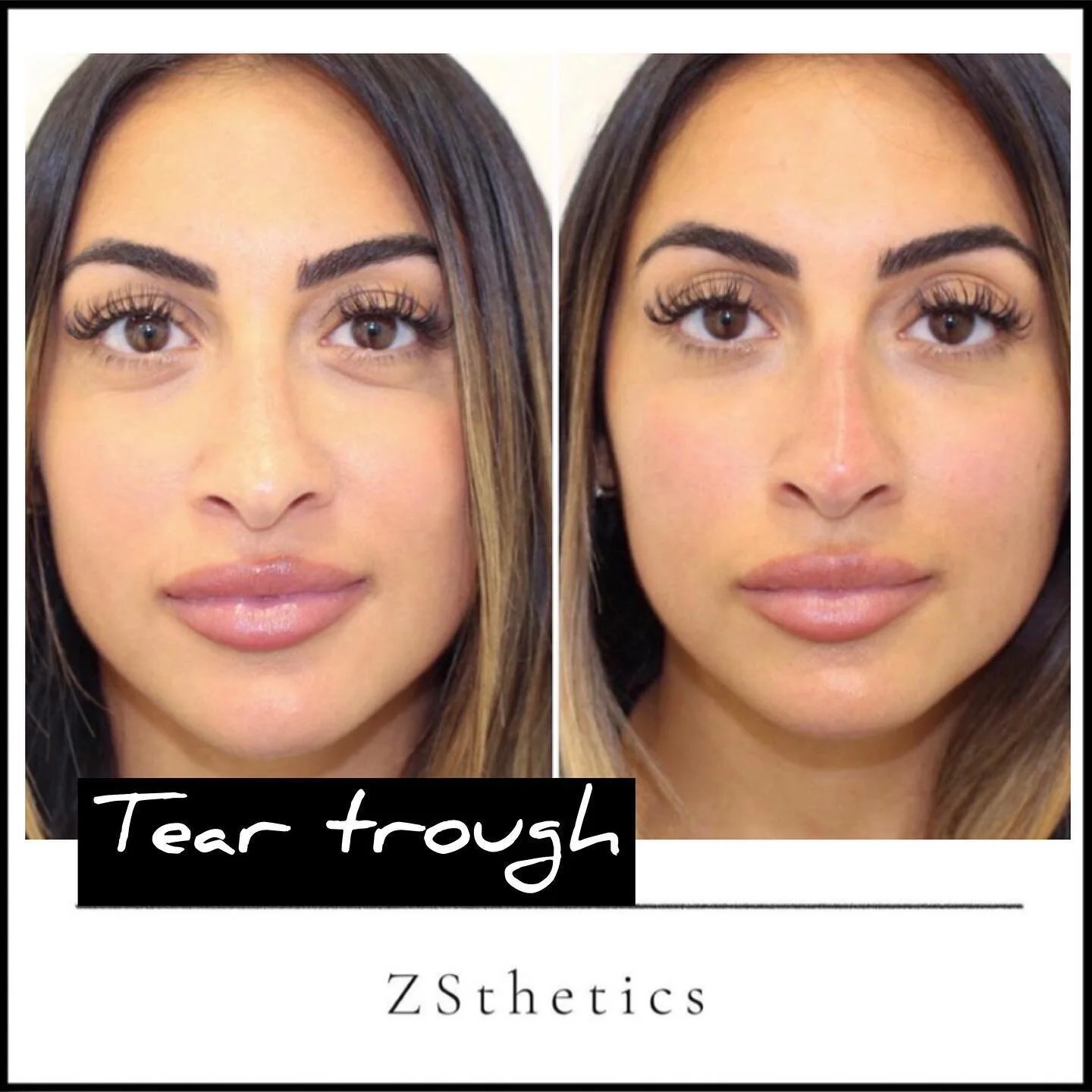 Although we have a backlog of results pictures we need to post, we just couldn&rsquo;t wait to share this one and so this beauty jumps the queue. 

This gorgeous being works as a personal trainer and the side effect of getting into the incredible sha